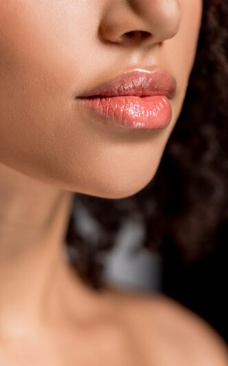 Close-up of a persons face focusing on glossy, slightly parted lips. The skin is smooth, and the persons hair is curly and partially visible on the right side. The background is blurred and dark. ladies face showing her lips after lip filler treatment